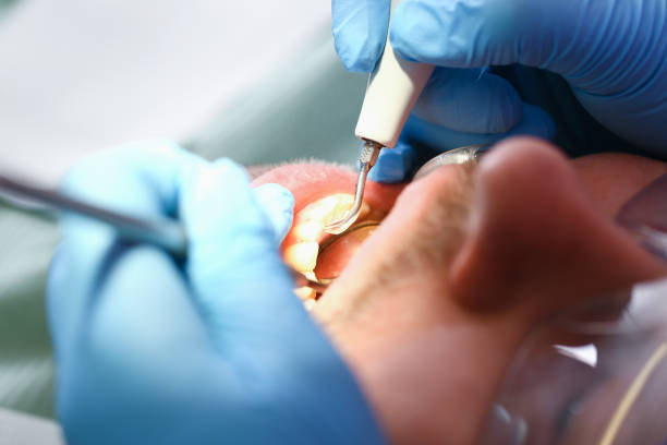 Best Pediatric Emergency Dentist in Westport Village, CT