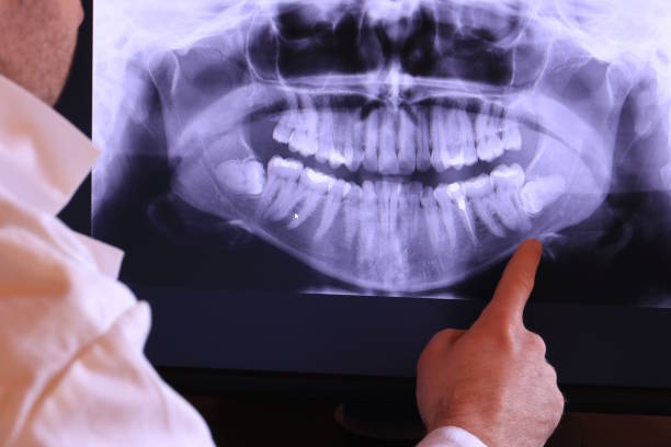Best Emergency Root Canal Treatment in Westport Village, CT